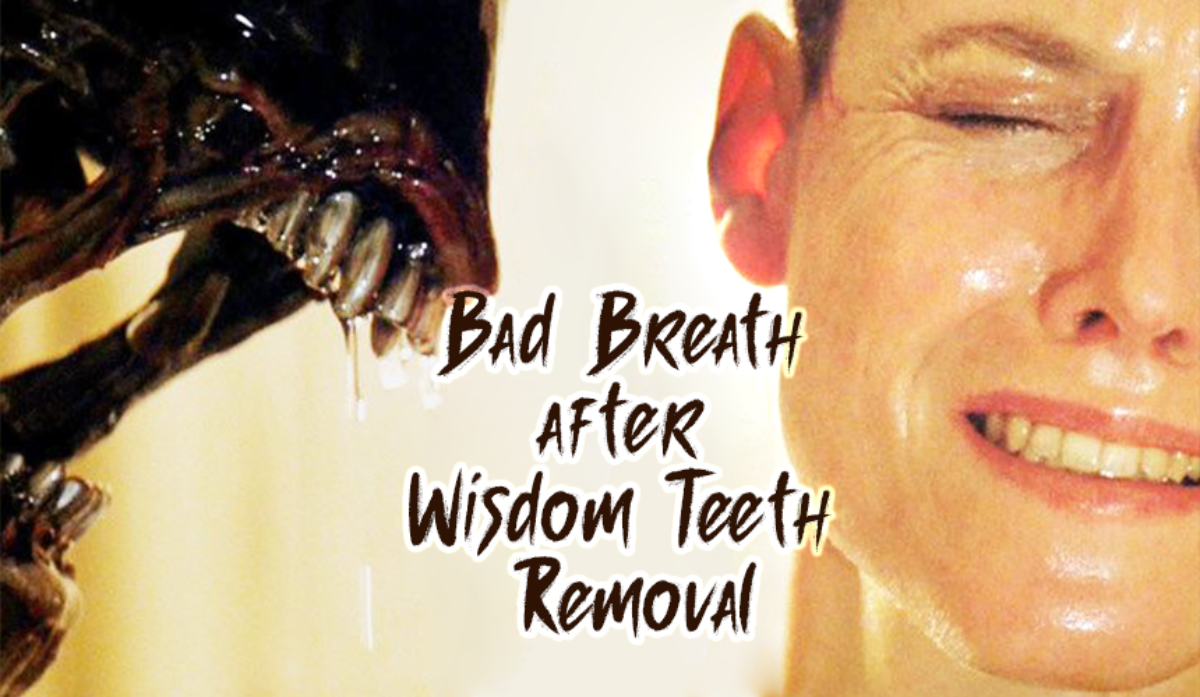 Oral Health Bad Breath After Wisdom Teeth Removal