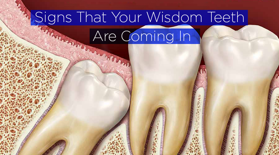 The Ways You Can Tell If Your Wisdom Teeth Are Coming In