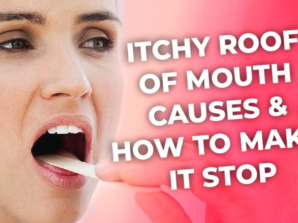 Itchy Roof Of Mouth Causes How To Make It Stop