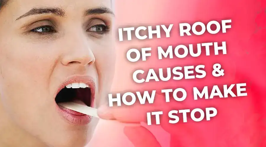 Itchy Roof the Mouth: Causes & to Make