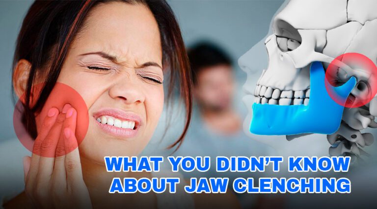 What You Didn’t Know About Jaw Clenching – Trust Dental Care