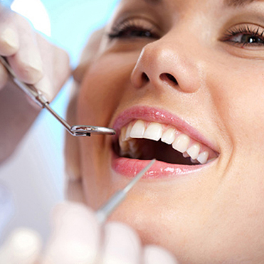 Dental Sealants & How They Can Save Your Smile 11