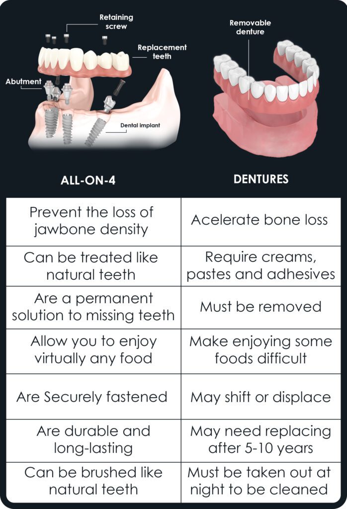 all on 4 vs dentures