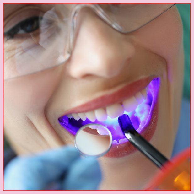 A woman receiving a dental sealant treatment as part of her dental care routine.