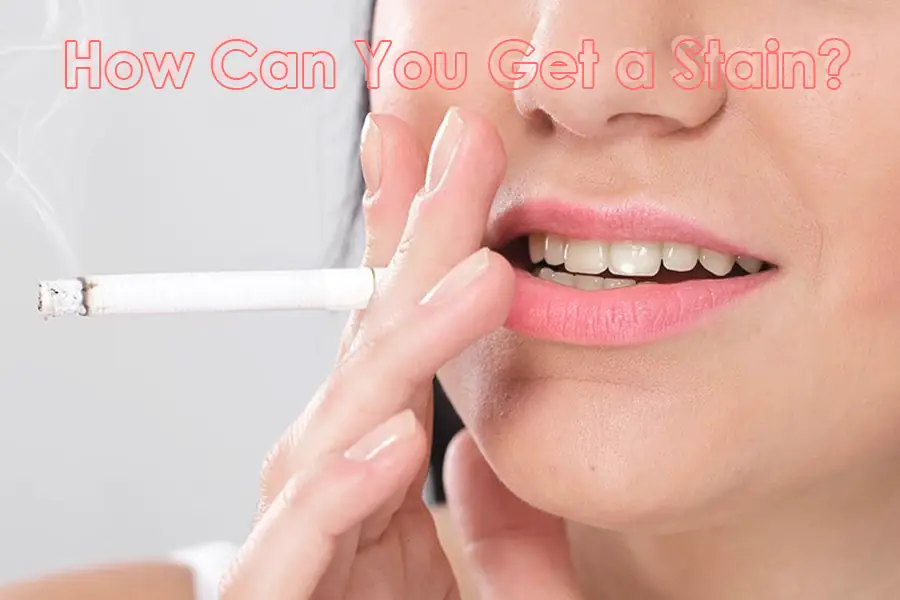 Can you get a stain Trust Dental Care