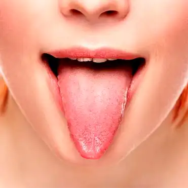 So What Exactly are swollen taste buds?