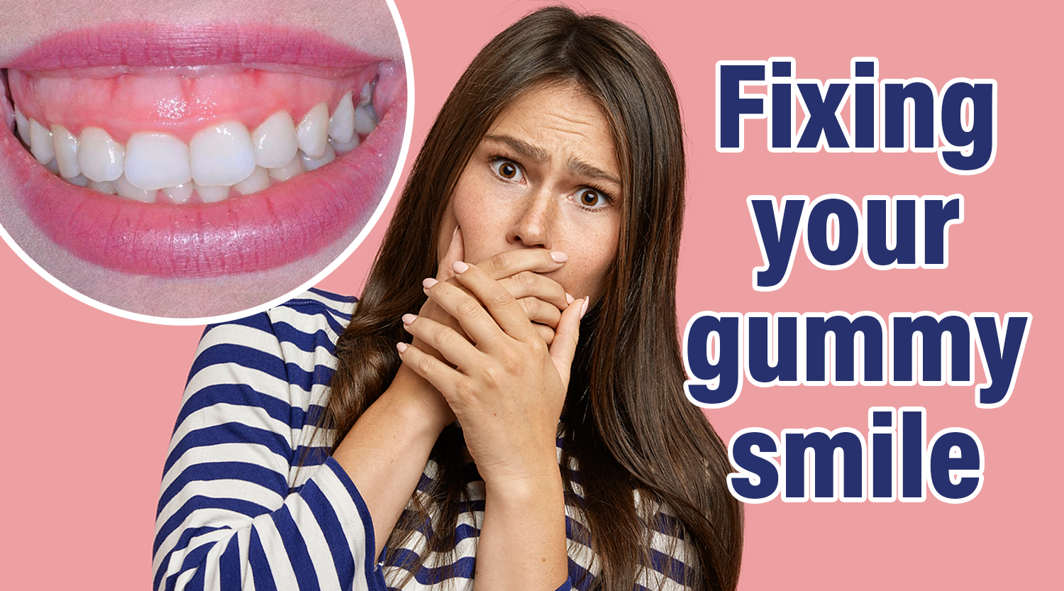 Is Your Gummy Smile a Real Problem?