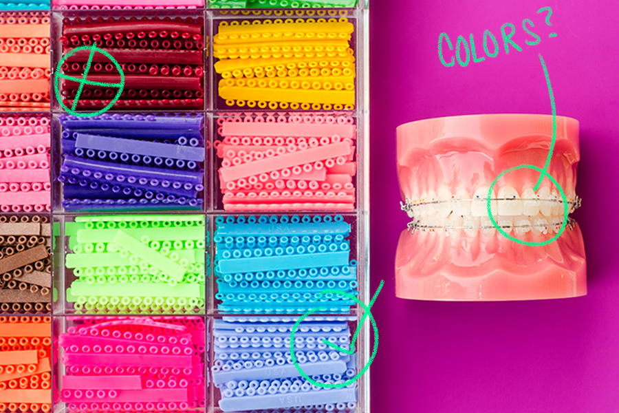 What Are The Best Colors for Braces, And Which Should You Avoid?