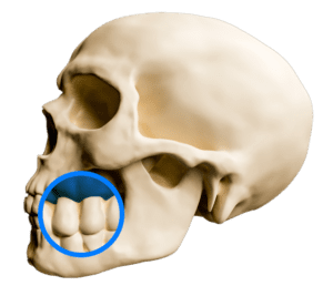 3D View of Skull Bone Graft Procedure