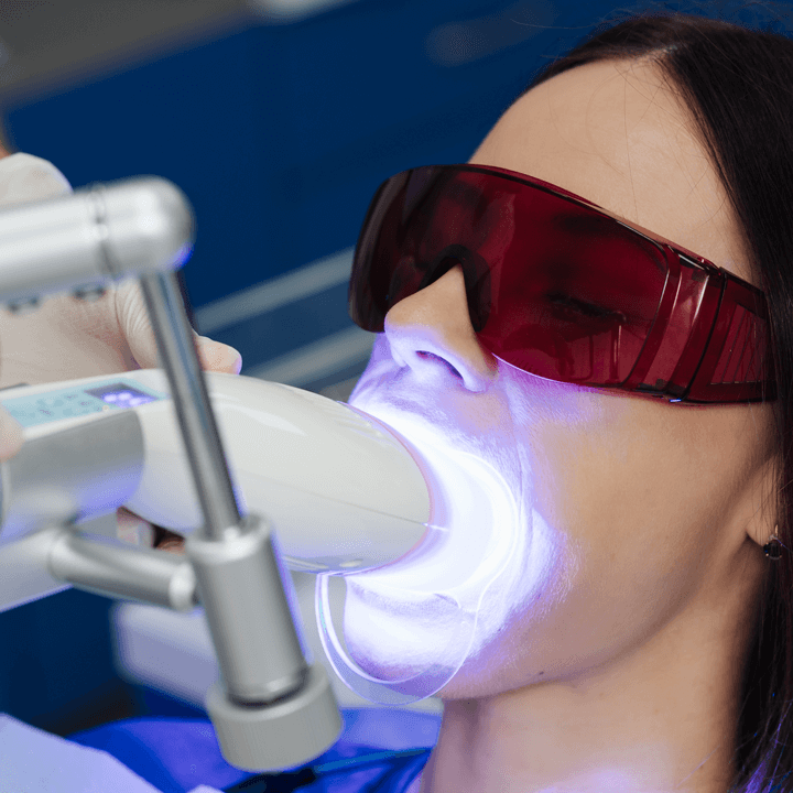 Laser Teeth Cleaning 3