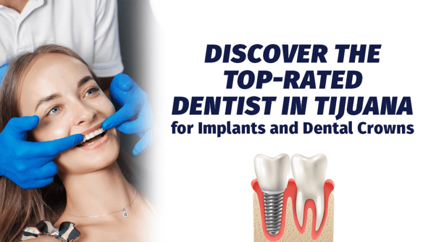 Discover the Top-Rated Dentist in Tijuana for Implants and Dental Crowns