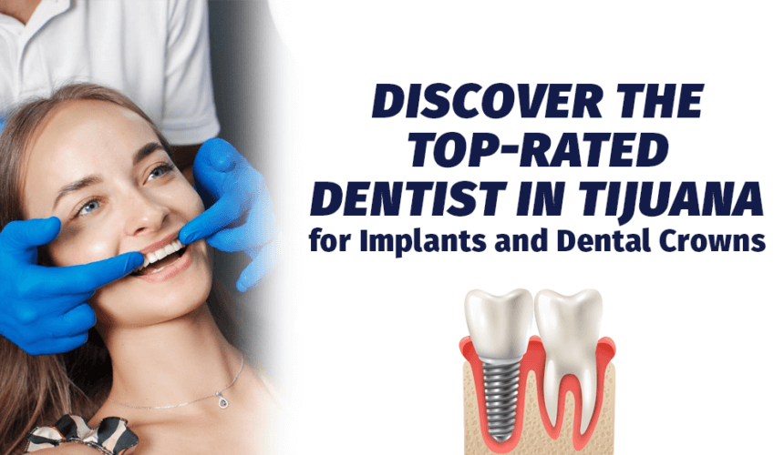 Discover the Top-Rated Dentist in Tijuana for Implants and Dental Crowns