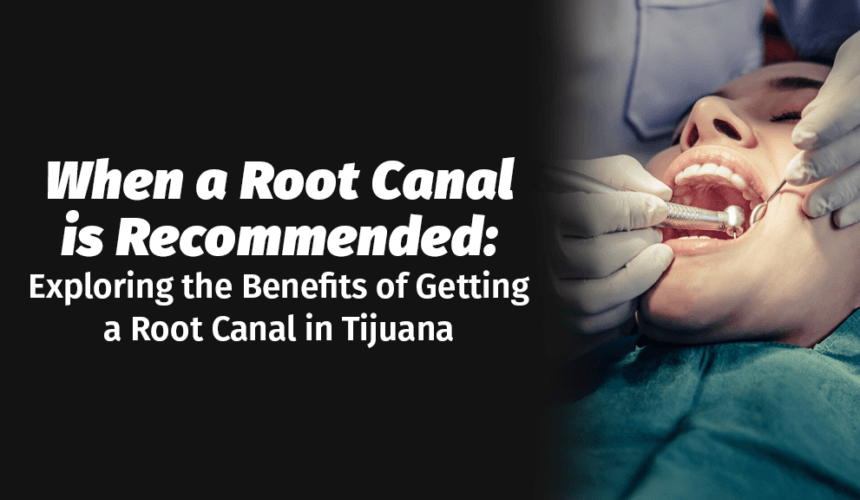 Understanding When a Root Canal is Recommended: Exploring the Benefits of Getting a Root Canal in Tijuana
