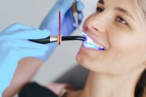 Laser dental cleaning in tijuana