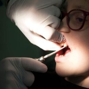 Phase 2 Dental Extraction