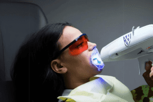 Zoom Teeth Whitening in Tijuana