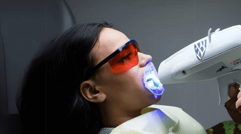 Zoom Teeth Whitening in Tijuana