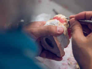 artist making dentures for patient dark room