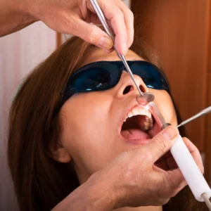 young woman in a laser dental cleaning treatment