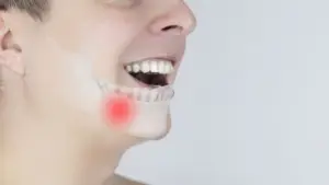 Osteitis Dental Bone Inflamation