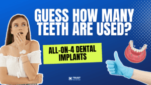 All-on-4 Implants