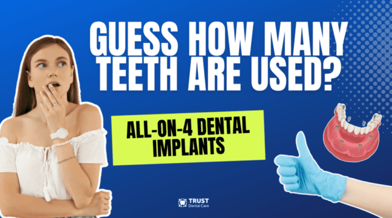 All-on-4 Implants