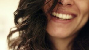 Smile makeover in Mexico