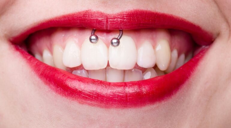 Tooth piercings