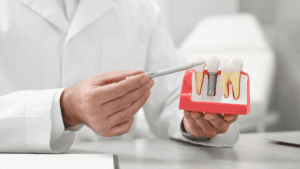 tooth in a day dental implants Types of Implants
