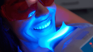 Best teeth whitening near me dental whitening