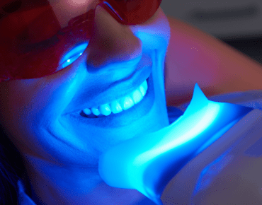 Best teeth whitening near me