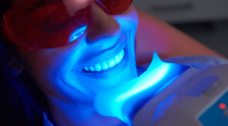 Best teeth whitening near me