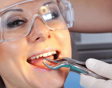 Dentist near me for tooth extraction