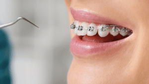 Orthodontics Tijuana