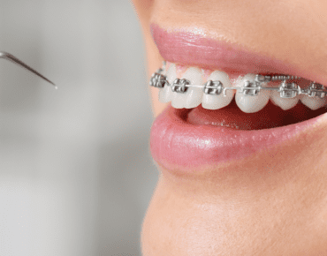 Orthodontics Tijuana