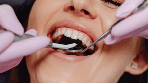 dental hygienist near me