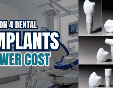 All on 4 Dental Implants Lowest Cost