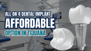 all on 4 dental implants price