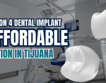 all on 4 dental implants price