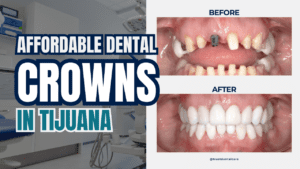dental crown near me
