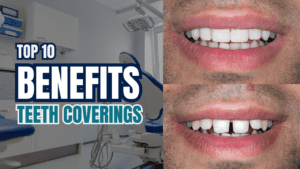 teeth coverings