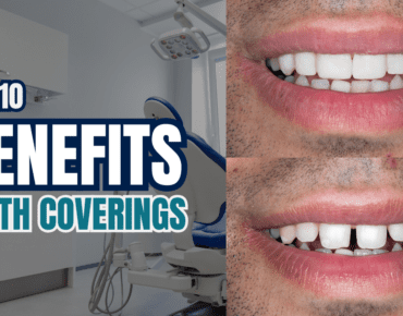 teeth coverings