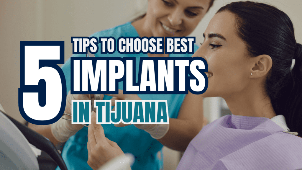 Best Dental Implants Near Me