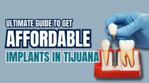 all on 4 Tijuana