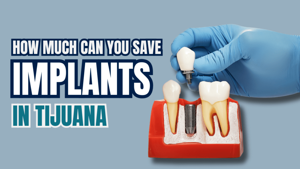 dental implants prices