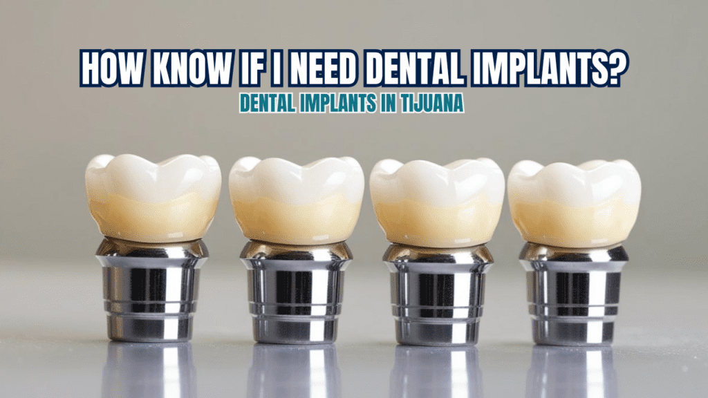 signs you need dental implants