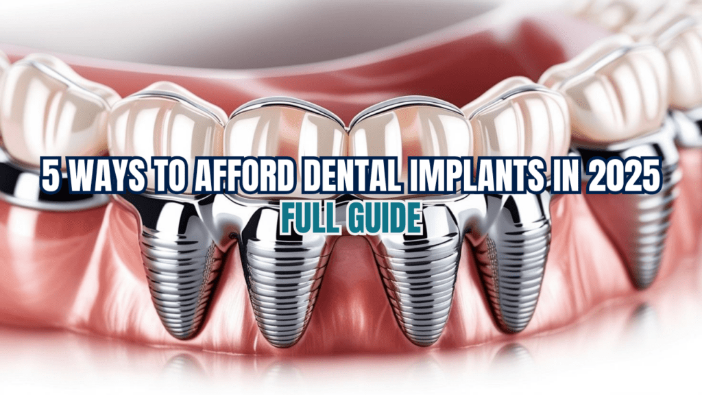 Afford Dental Implants