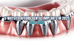 Afford Dental Implants