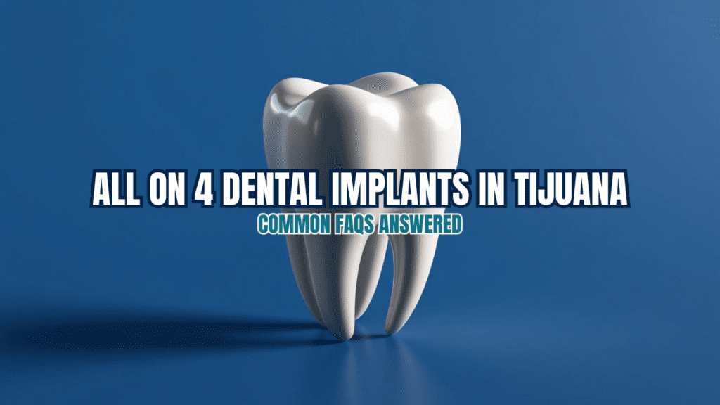 all on 4 dental implants