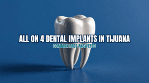 all on 4 dental implants